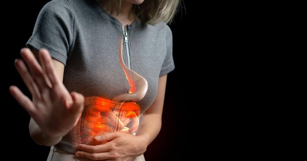 Ilustração anatômica mostrando o esôfago com sinais de inflamação causados pela candidíase esofágica.